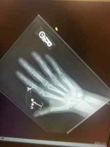 X Ray