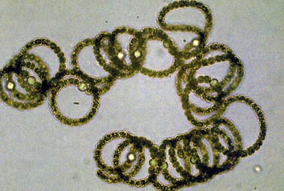 Anabaena sp. Another type of algae that's important to a plankton bloom